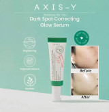 بهترین سرم ضد لک